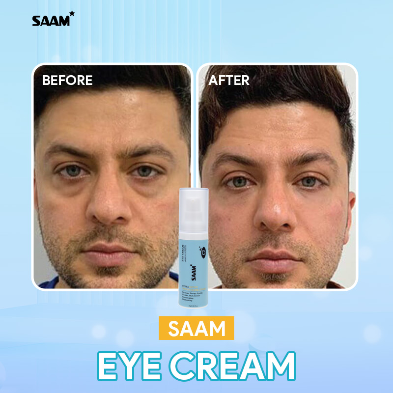 Eyes skin improved after using SAAM cream