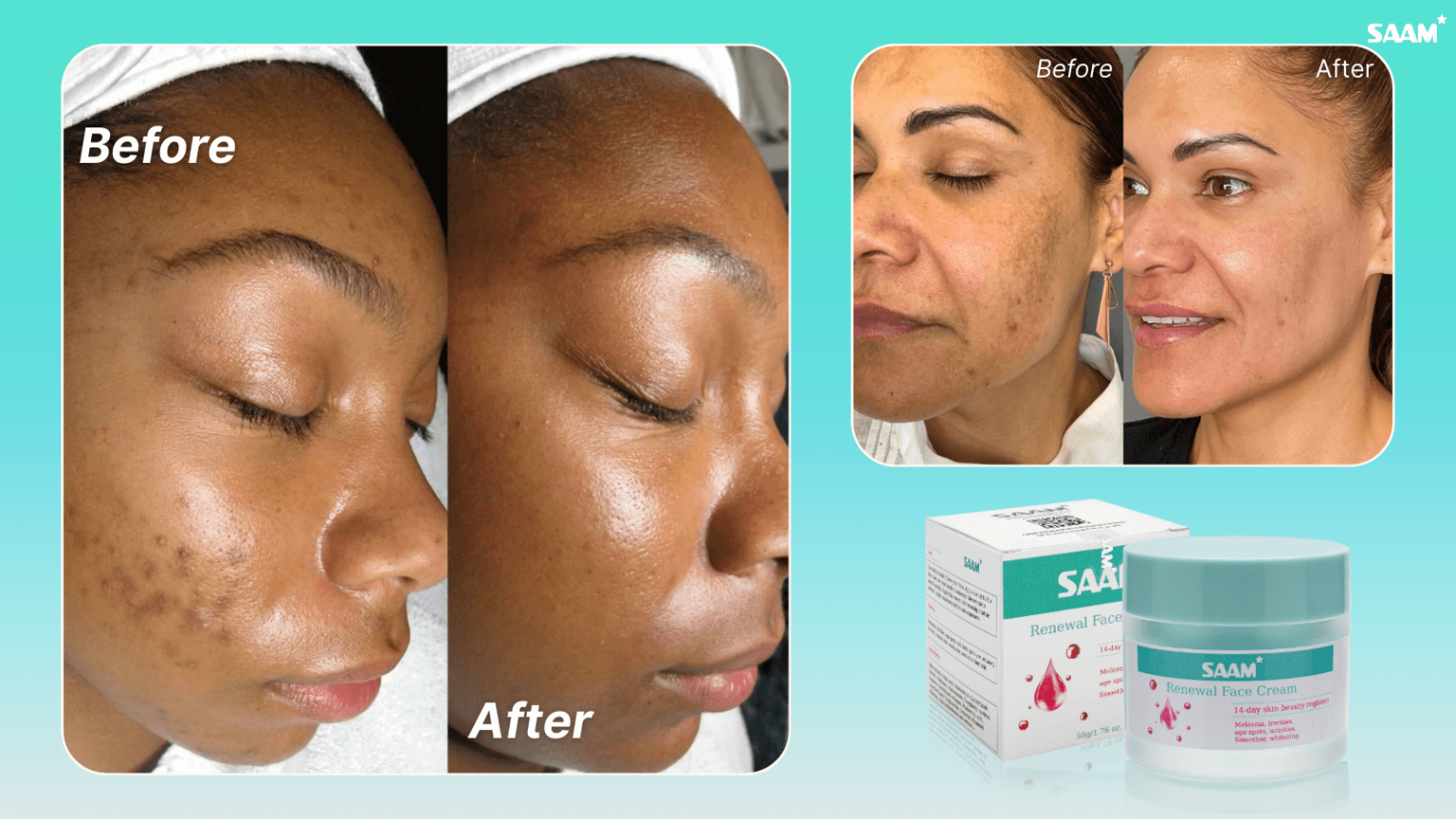 SAAM Cream delivers fast results on skin without irritating