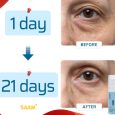 SAAM Eye Cream Improves Eye Skin Area Issues